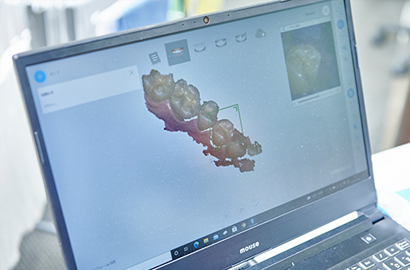 不快感が無く正確な型どりを可能にする口腔内3Dスキャナー02